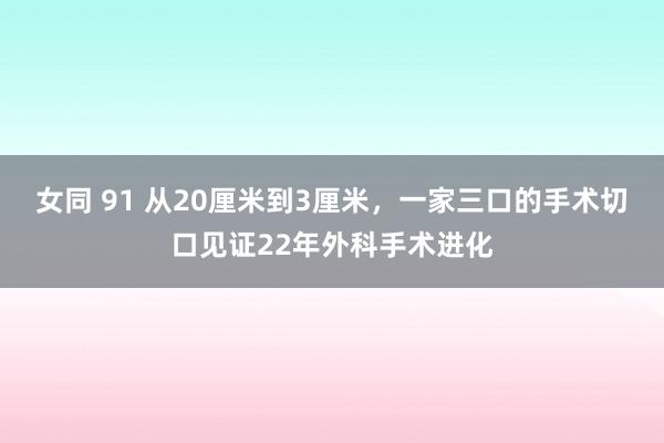 女同 91 从20厘米到3厘米，一家三口的手术切口见证22年外科手术进化
